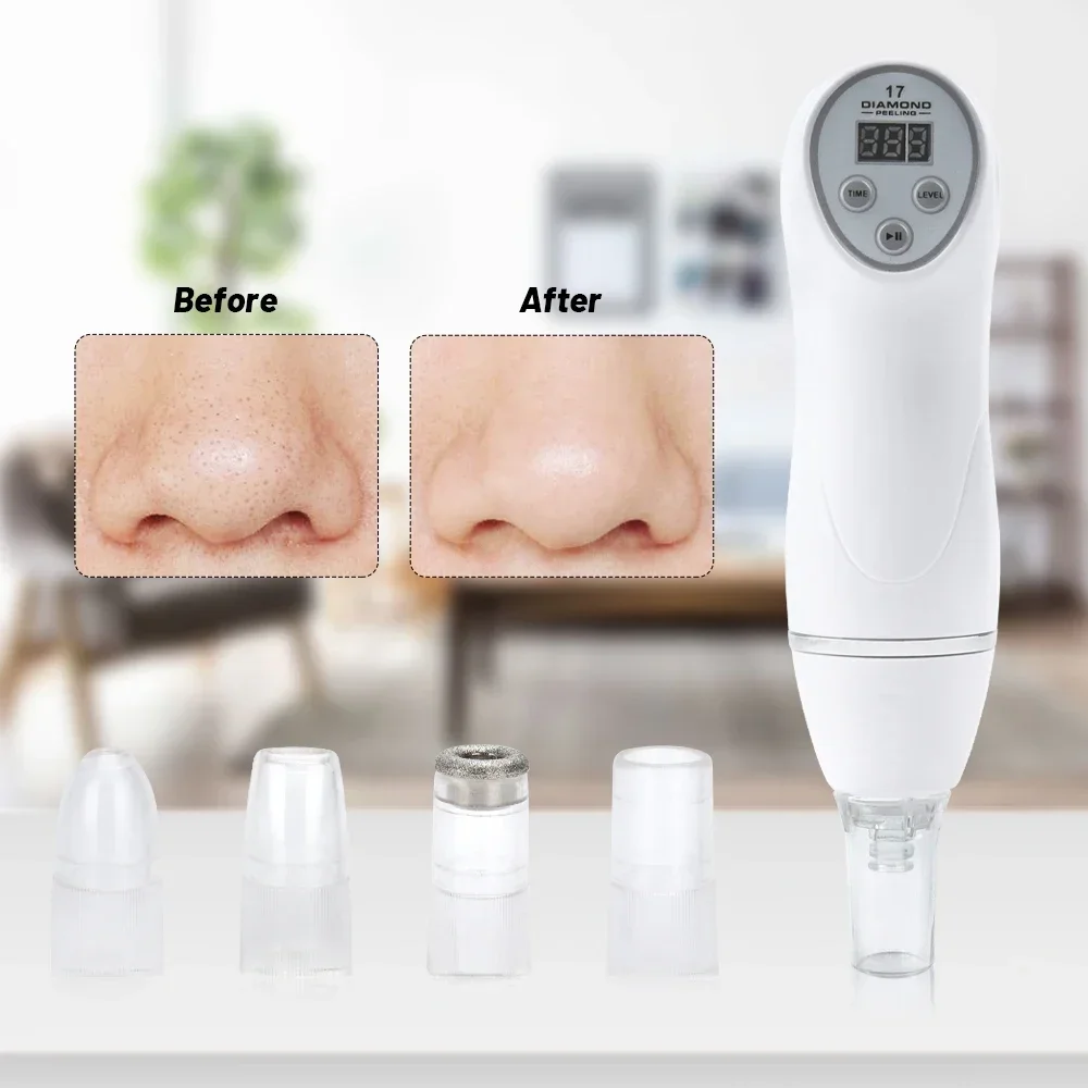 7 Tips Digital Diamond Microdermabrasion Vacuum Blackhead Cleaner Facial Acne Mark Removal Machine Deep Cleaning Pores Skin Care