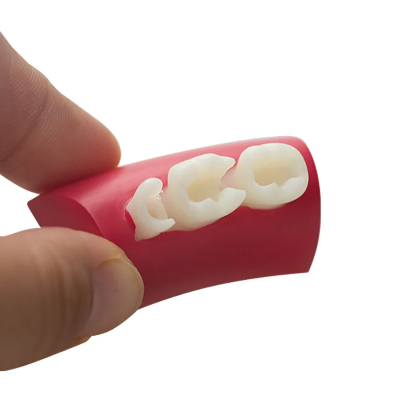 1pcs Dental Inlay Exercise Model Block Filling Exercise Typodont Resin Materials Oral Filling Model For Dentistry Teaching Study