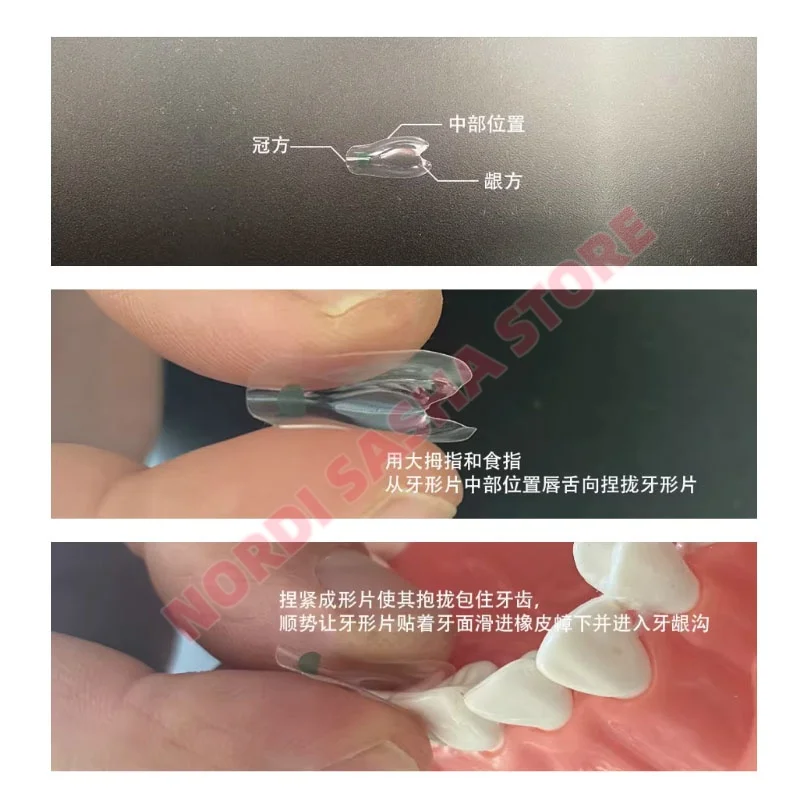 150Pcs/Box Dental Signet Transparent Matrix Trial System Clear Anterior & Posterior BioClear BT Black Triangle Matrices Wedges