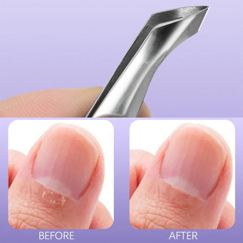 Nail Art Cuticle Nipper Clipper Edge Cutter Mini Hangnail Squeeze And Snip Toenail Ingrown Dead Skin Remover Manicure Plier Tool