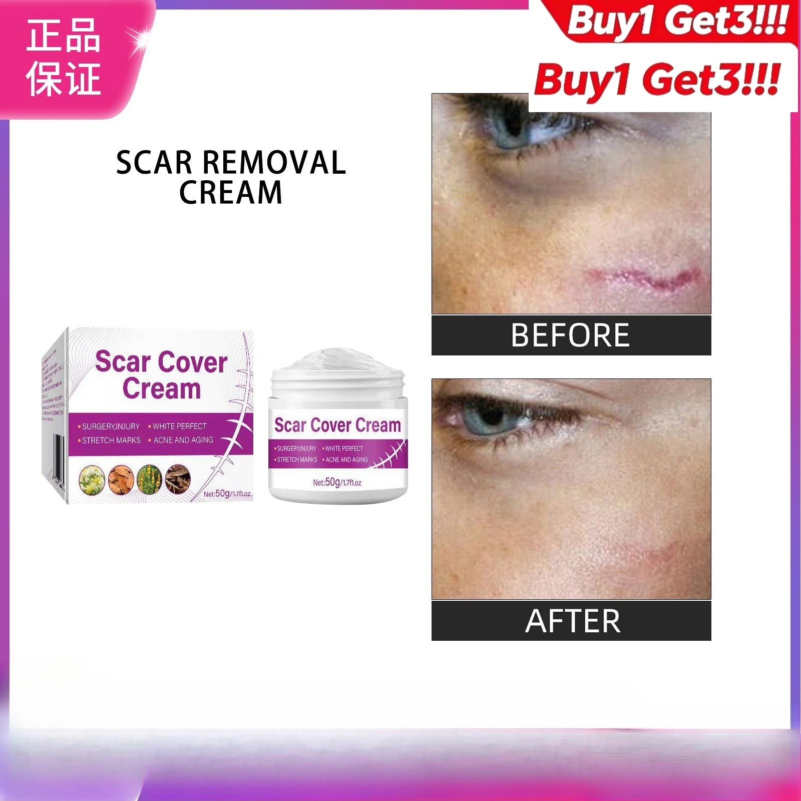 

Buy 1 Get 3 Skin Care Cream Gentle Moisturizing Body Balm for Scar Care & Skin Smoothing