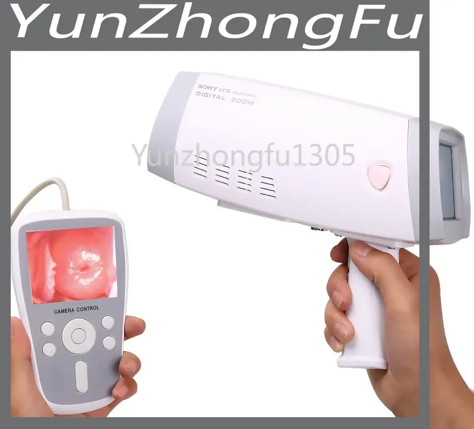 Clinical Vaginal ccd Camera MSLCE04 Handheld Video Colposcope for Gynecology