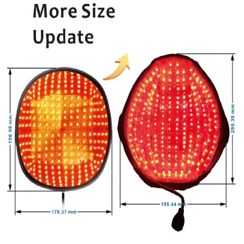 

Лазерный шлем для роста волос с 276 диодными лазерами, длина волны 650нм+808нм