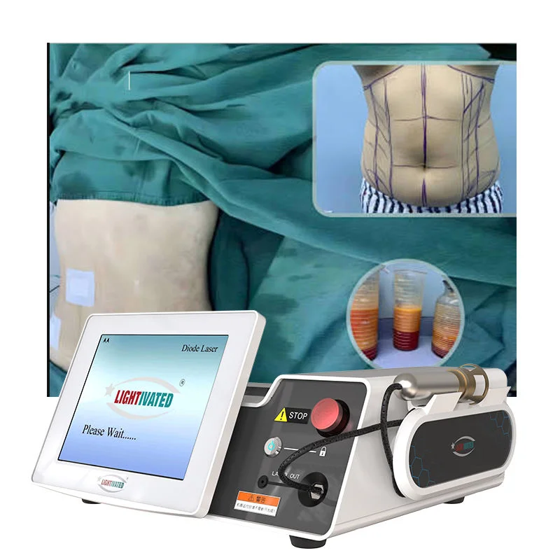 

PLDD 980/1470nm Fiber Laser System for Lipolysis, Lifting, Slimming, Skin Tightening, and Anti-Cellulite Treatment