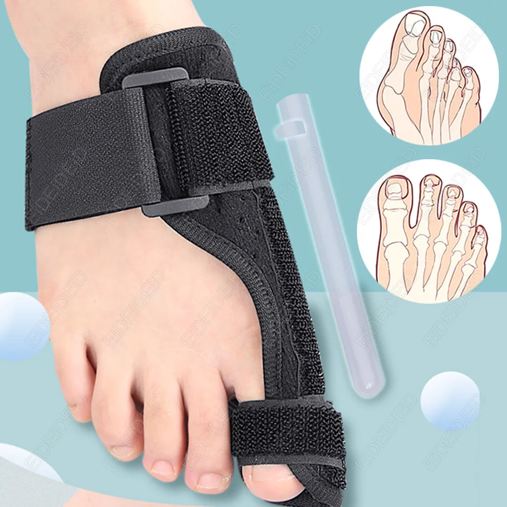 Bunion Corrector for Women Men Big Toe Adjustable Bunion Splint for Bunion Relief Toe Straightener for Day Night Support pads