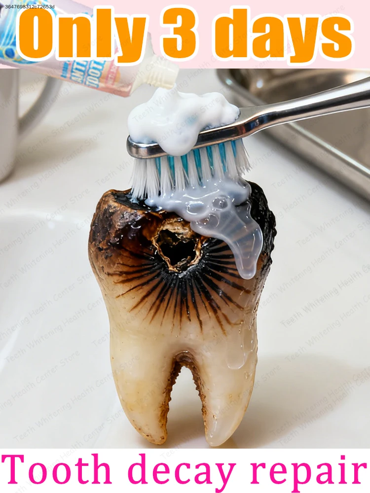 Effective oral cleaning and ᴛᴏᴏᴛʜ ʀᴇᴘᴀɪʀ ɪɴ 3 ᴅᴀʏs