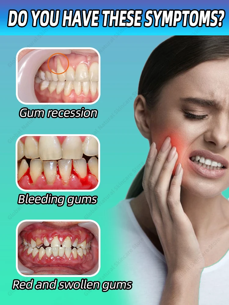 Gum Strengthening Teeth Mousse