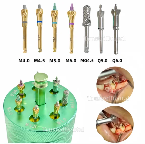 

Набор хирургических инструментов для контурирования и обработки костной ткани при имплантации зубов: фрезы, триммеры, коллектор, GBR-набор