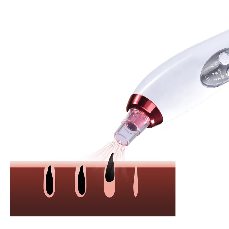 متعددة الوظائف فراغ مزيل الرؤوس السوداء قابلة للشحن نانو الوجه ضباب البخاخ الكهربائية الوجه باخرة #2