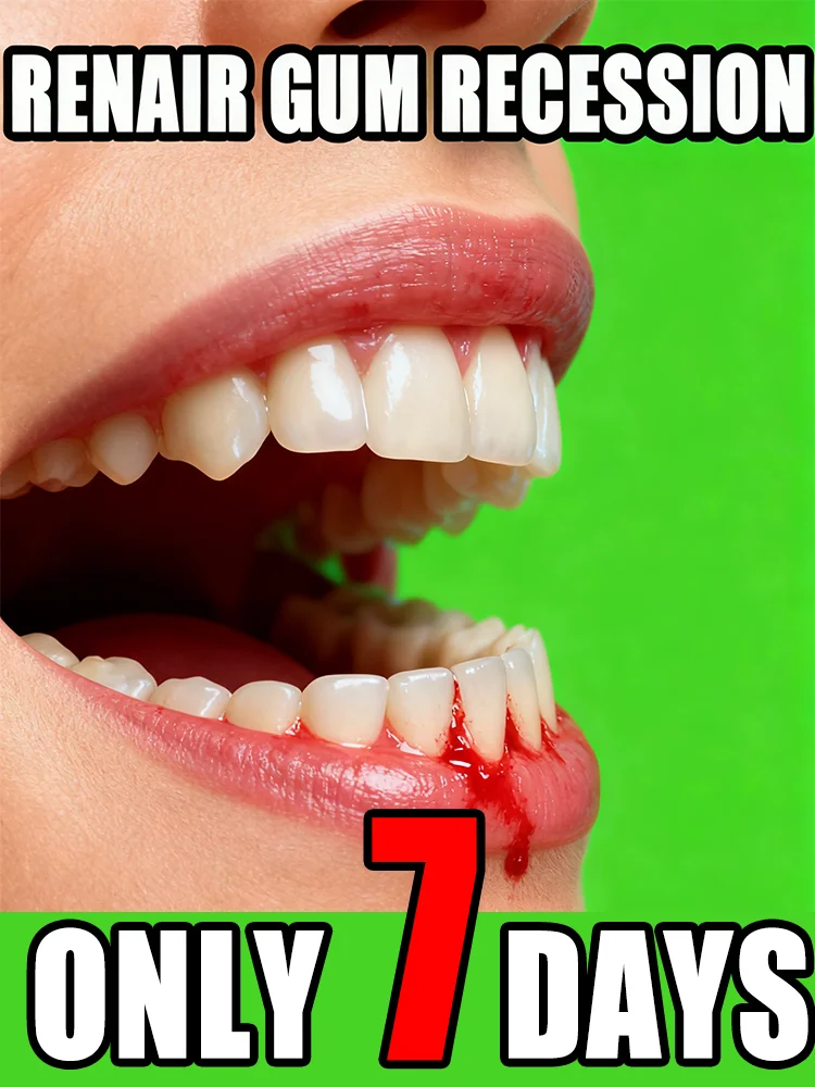 

A one-week gum care plan! Gum regeneration covers teeth, resulting in a flawless smile.