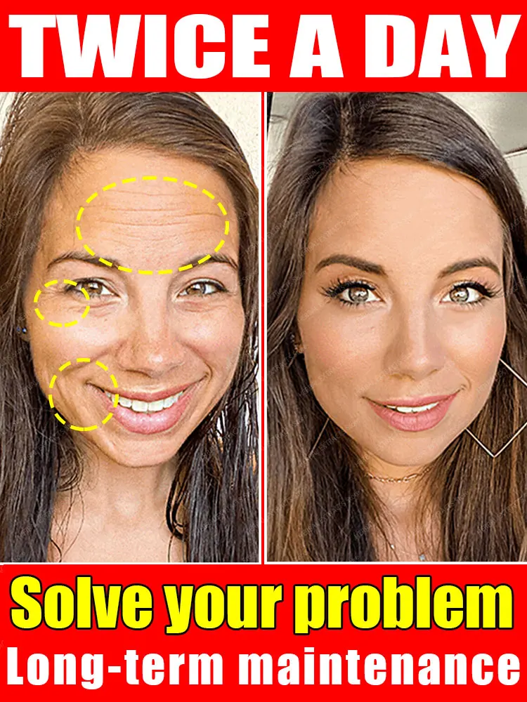 

Секрет омоложения коллагена: удаление морщин и разглаживание кожи