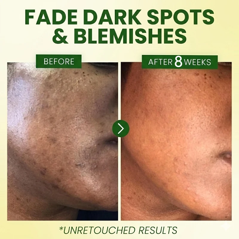 Advanced Green Tangerine Vita-C Dark Spot Care Cream with 5% Niacinamide Brightening Hydrating Korean Skincare Non-irritating