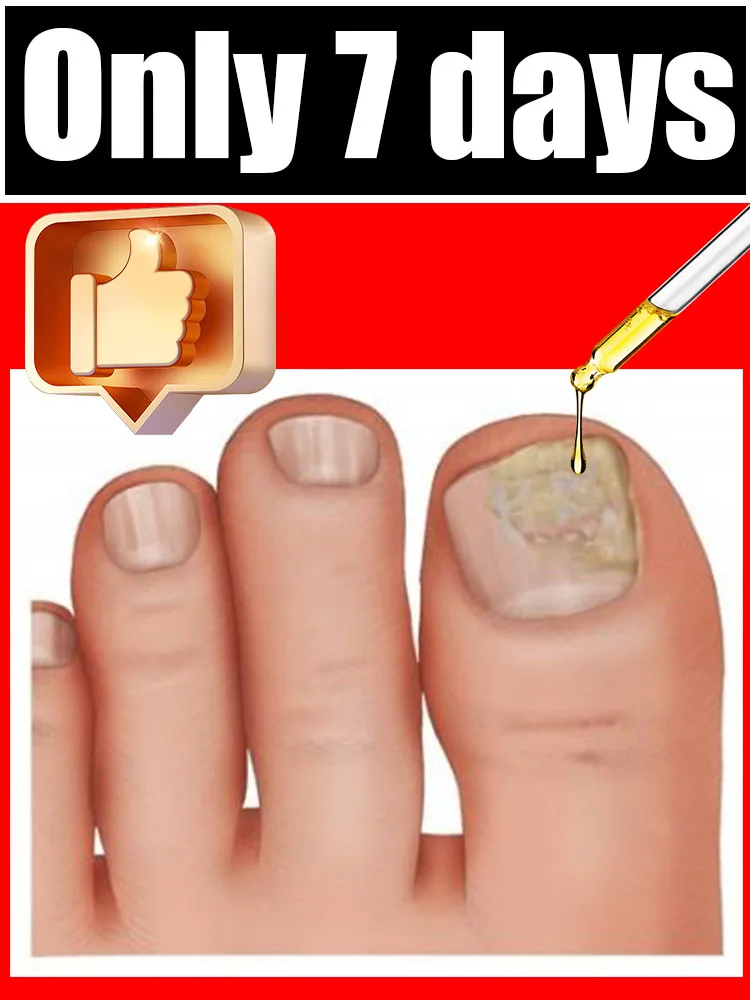 2025 Toenail Fungus Patch Waterproof Nail Repair Patches Nail Ingrown Correction Sticker Discolored Damaged Nail Foot Care Tool