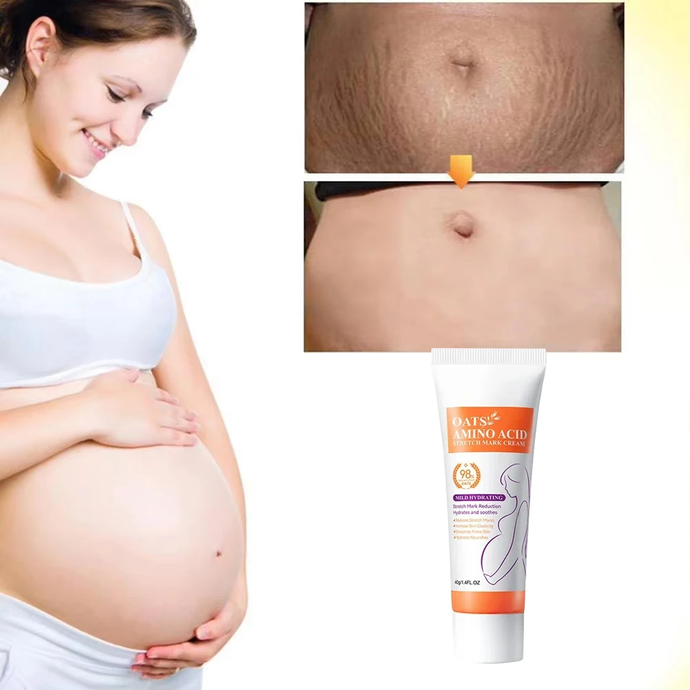 Pregnancy Repair Stretch Mark Removal Acne Scar Maternity Stretch Marks Remove Fat Striae Scars Treatment skin Care