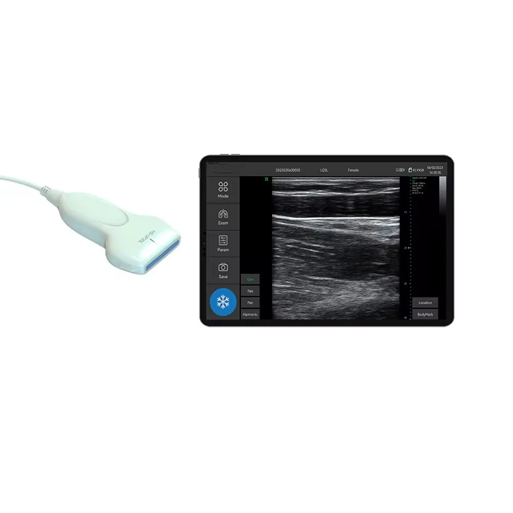 Handheld Type C USB usb interface b ultrasound scanner linear probe