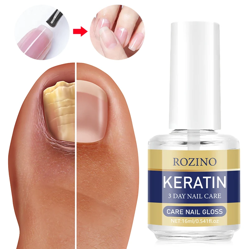 ROZINO 3-day nail care oil comes with a convenient brush head for even and smooth application. The entire set is divided into separate small portions, making it easy to store and carry without any burden when going out. The oil has a light and thin texture, leaving the nail surface and cuticles feeling clean and fresh. It doesn't easily attract dust or debris and can be used both before and after manicures. The complete set can meet the daily care needs of nails over a short period of time.
