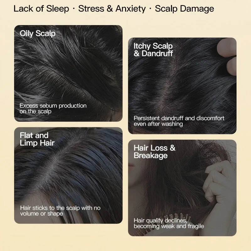 แชมพูก้อนป้องกันผมร่วง! แชมพูสมุนไพรแพลติคลาดัส อูสเนีย ควบคุมความมัน ลดรังแค ลดการขาดหลุดร่วง ผลิตด้วยมือ ช่วยเพิ่มวอลลุ่ม