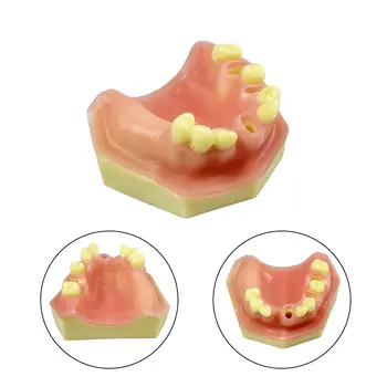 植牙實踐模型:下顎竇軟性牙齦模型,適用於牙醫學生訓練教學示範診所模型 8 最佳銷售 牙醫學生 - №3