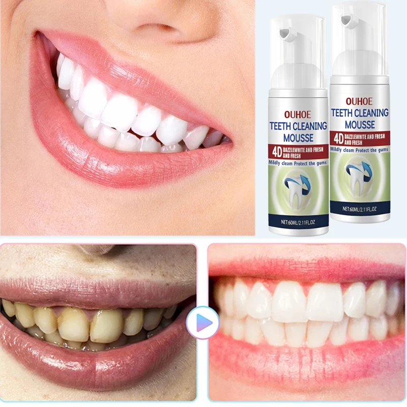 

Removal Plaque Stain Teeth Whitening Toothpaste Yellowing Oral Clean Care