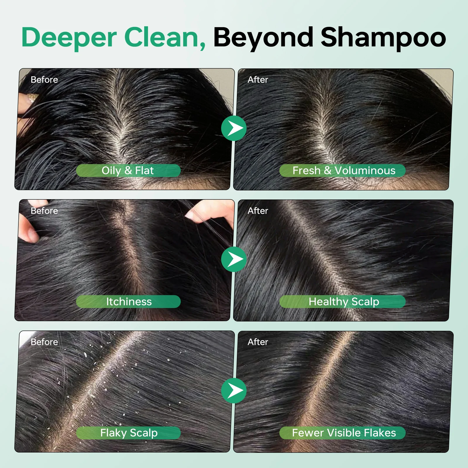 منظف تقشير لفروة الرأس 250 مل من روزماري للتحكم في زيت فروة الرأس للحكة والتحكم في فروة الرأس وعلاج العناية بالشعر 8.80 أونصة سائلة