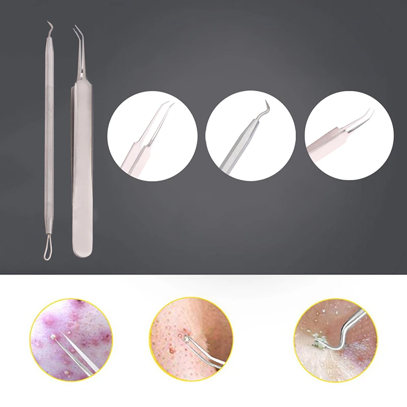 2Pcs/Set Blackhead Remover Comedone Acne Stick Pimple Extractor For Faces Black Dots Tweezers Beauty Facial Skin Care Tools