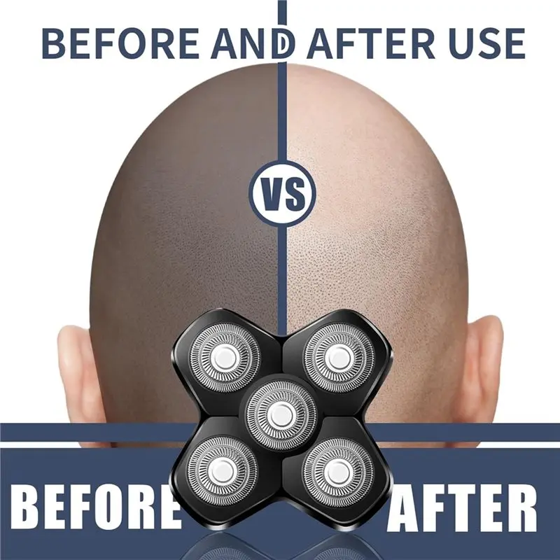 【الضرورة】للرجال 2 قطعة لماكينة حلاقة القبة MANSCAPED، 5 شفرات استبدال الرأس المغناطيسي، مرفق مغناطيسي #3