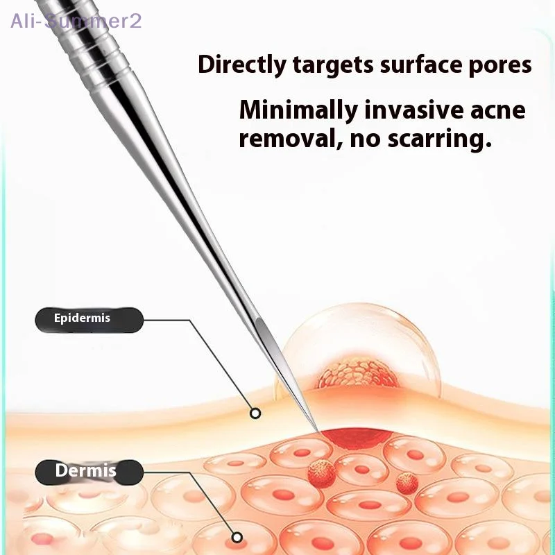 {MX} Clip de espinillas y espinillas ultrafinas, acero inoxidable, partículas de grasa para acné, elimina la aguja, herramientas de limpieza de belleza facial