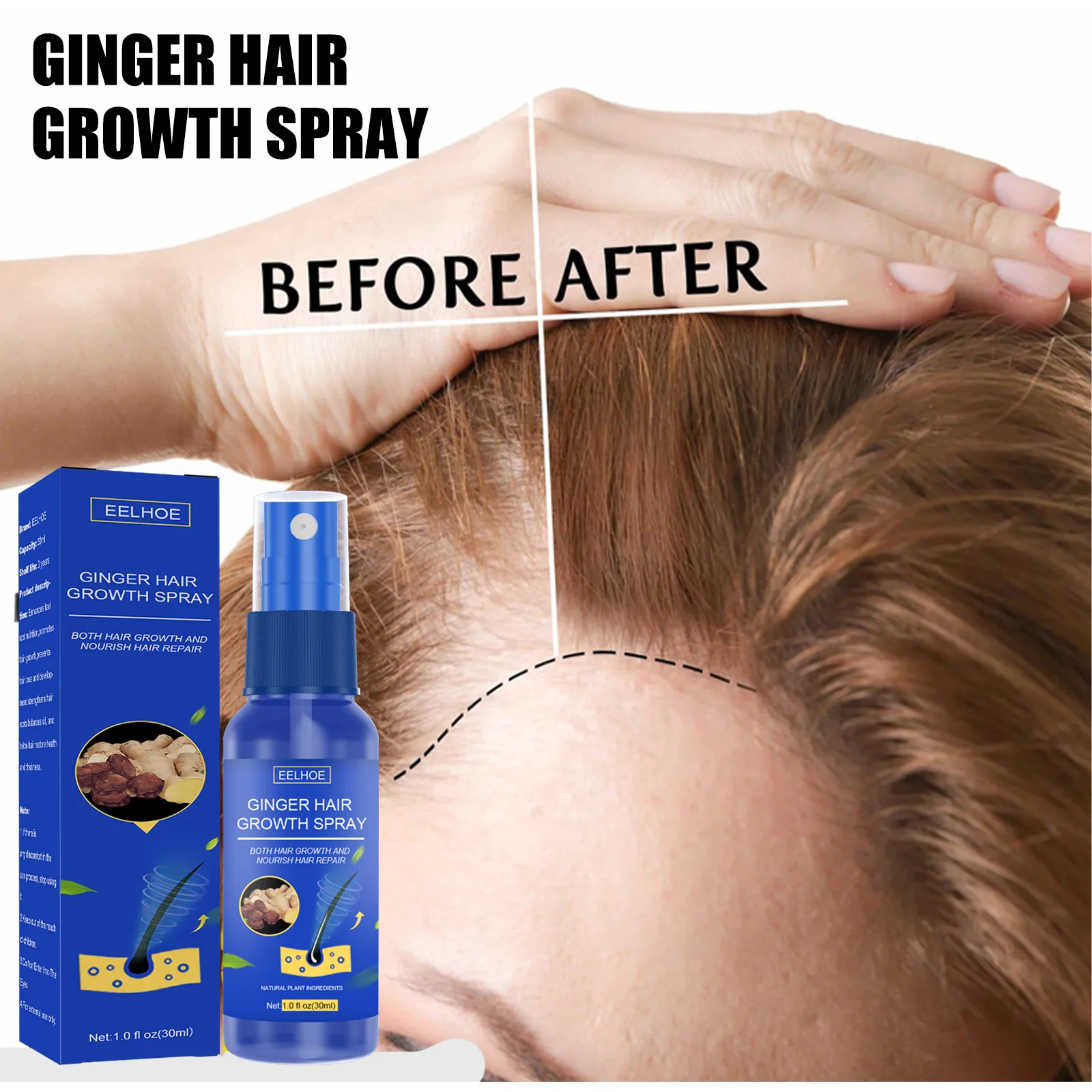 Hair Growth Spray Promote Fast Thicker Longer Ginger Extract Prevent Baldness Moisturize Scalp Anti Hair Loss Treatment Oil 30ml