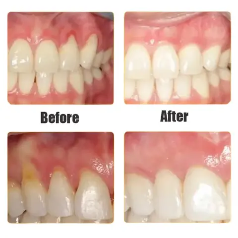 10 best sales चिकलेट - №8