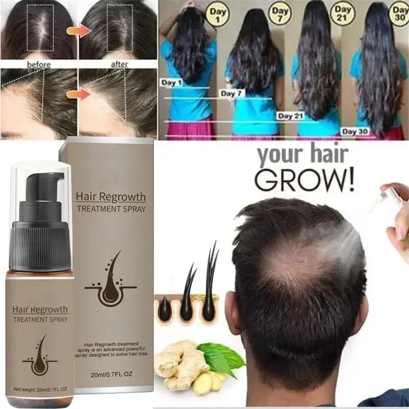 Vendas quentes eficaz rápido crescimento do cabelo soro reparação de calvície hereditário pós-parto seborréico anti perda cuidados para homens mulheres couro cabeludo c