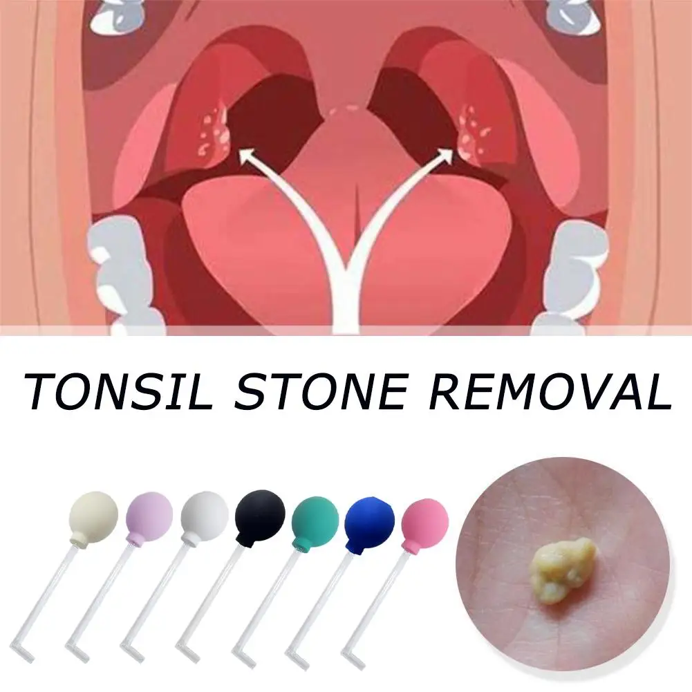 Tonsil Steenverwijderingsgereedschap Handmatige Verwijderaar Mondreiniging Verzorgingstool Oorsmeer Tonsil Steen Zuigbal Reiniger Amandelen Steenverwijderaar