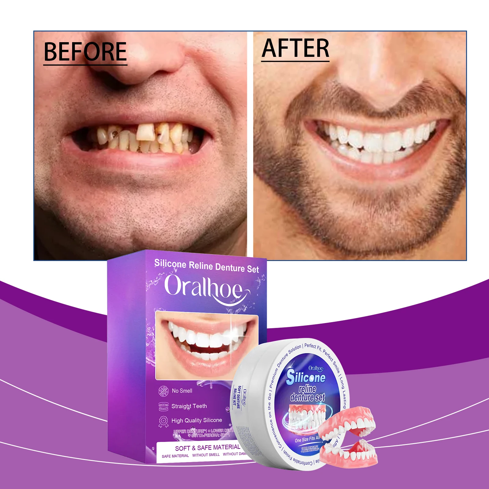 Silicone  Denture Set Soft Silicone False Teeth Kit Natural Smile Comfort Fit  Practical Oral Beauty Accessory For Daily Use