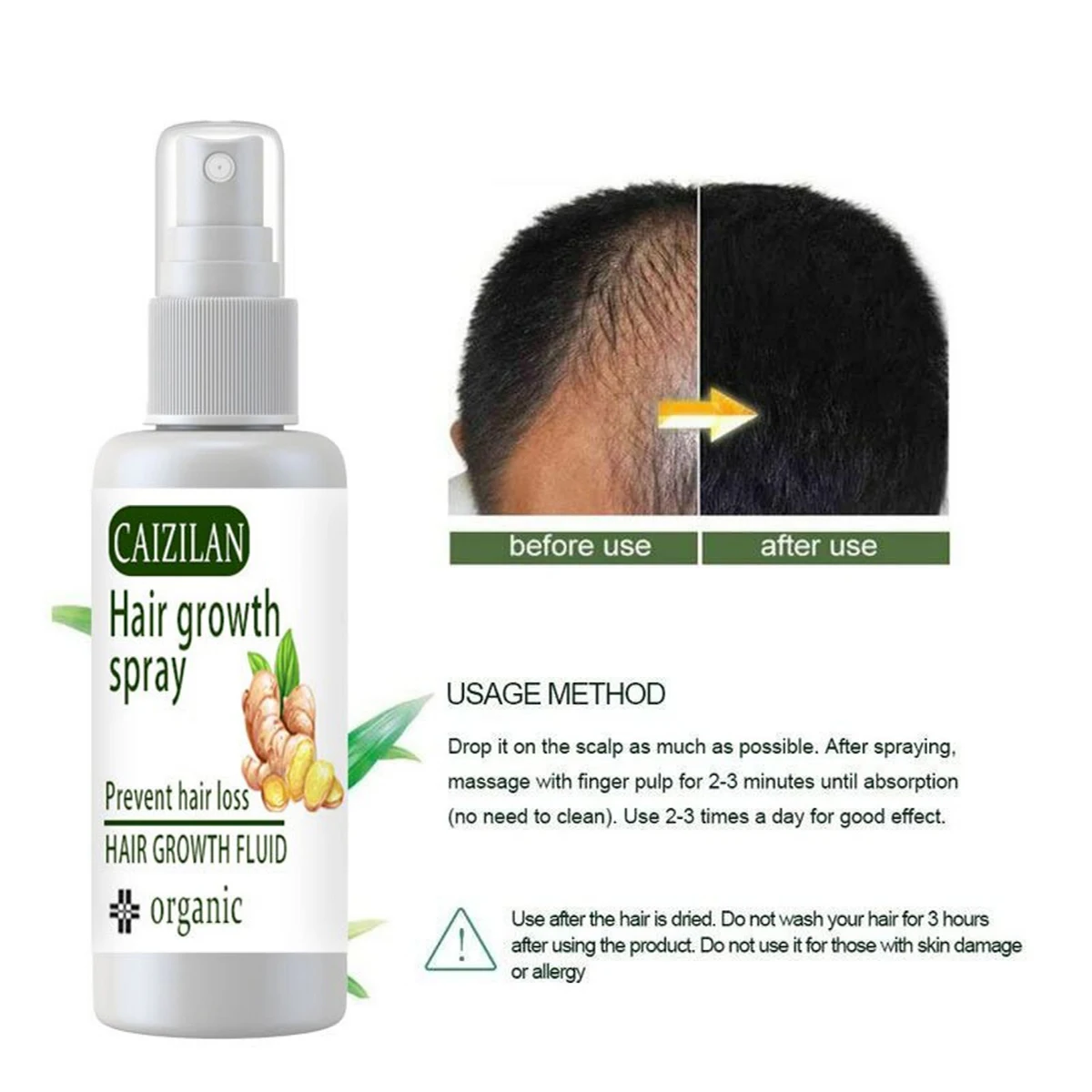 Produtos de crescimento do cabelo do gengibre rápido crescimento do cabelo óleo essencial beleza cuidados capilares evitar a perda de cabelo óleo