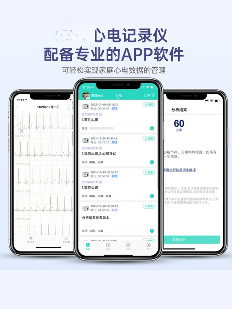 Twelve-lead 24-hour ECG machine detector, ambulatory heart   medical