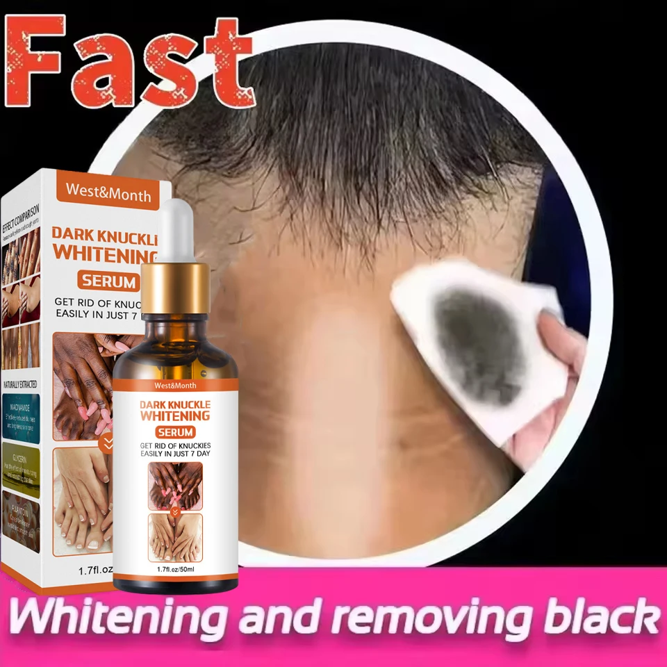 

Body Whitening Serum Dark Spot Remover For Underarms Knees Elbows Melanin Bleaching Lightening Skin Brighten Essence 50ml