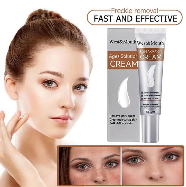 Remove Freckle Cream Whitening Dark Spots Effective Remove Melasma Serum Melanin Moisturize Brighten Smooth Face Skin Care 2