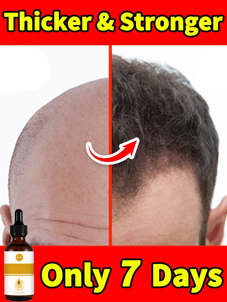 

New Thinning hair is no longer a problem. Our hair growth products increase hair density and give you thicker hair!