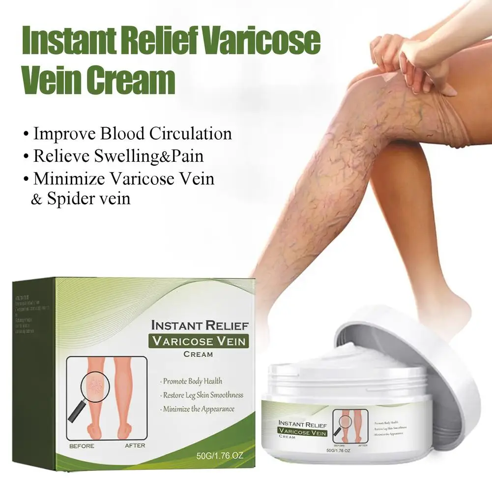 Crema reparadora de venas varicosas Tongmai, 50g, eficaz, alivia el dolor en las piernas, crema para tratamiento del dolor, vasculitis, flebitis, crema reparadora de venas
