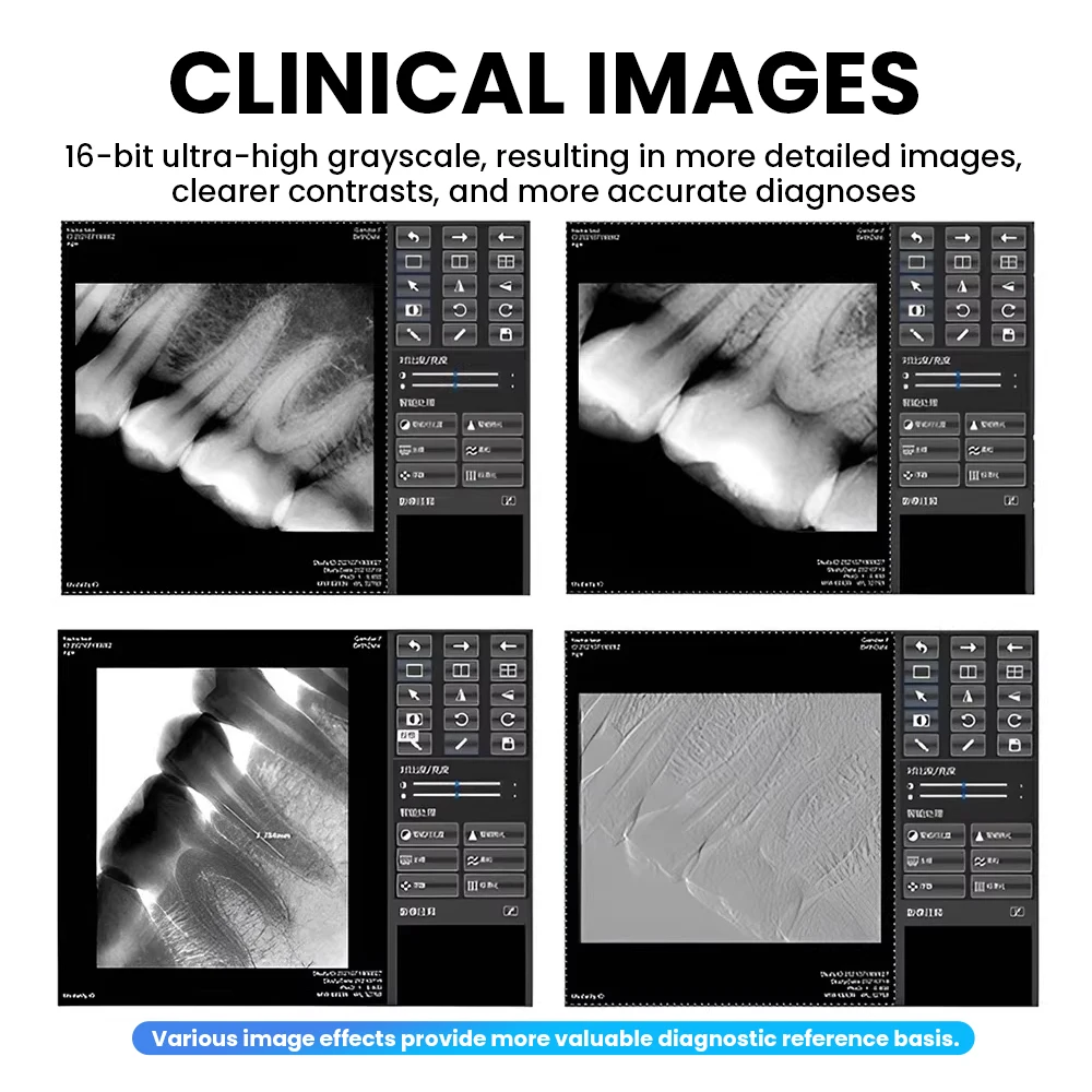 IP67 Waterproof Dental X-ray Sensor DynImage Fast Transmission Digital Intraoral System