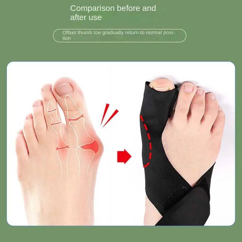 Toe Valgus Protector, tala Toe, apoio conjunto, correção do pé, ferramentas de cuidados com os pés, artrite