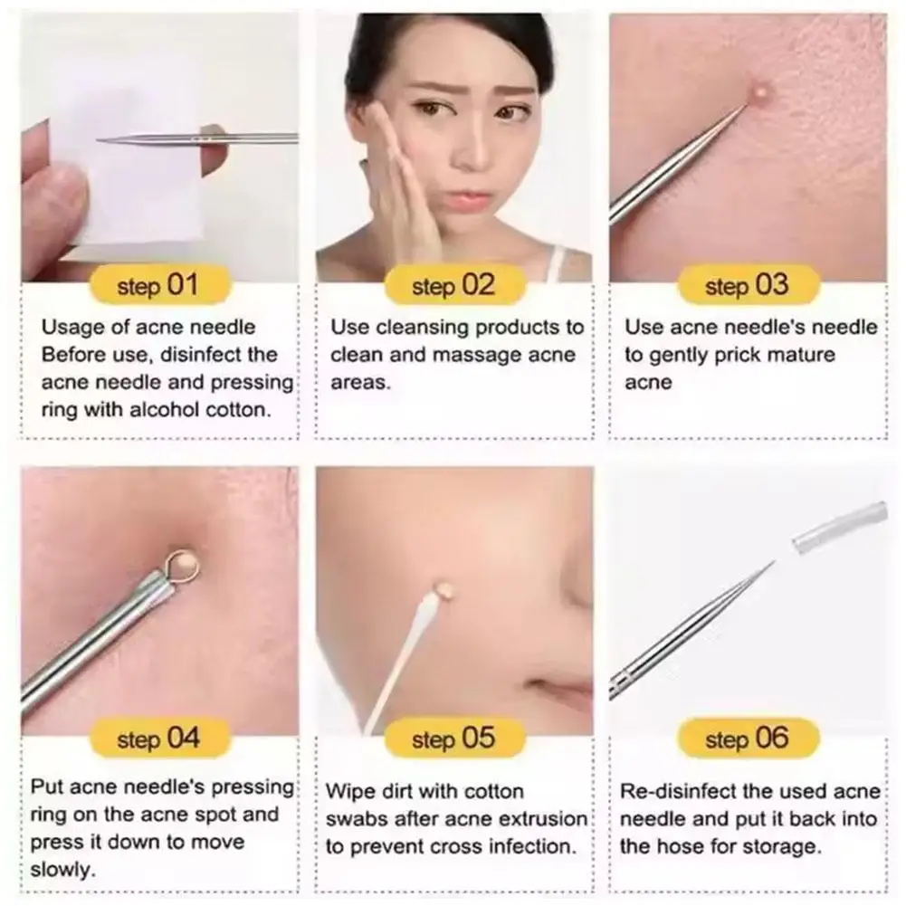 Mee-eter verwijderaar Dubbelzijdig mat ontwerp Evenwichtig Comfortabel voor alle huidtypes Verwijdert effectief acne-witheads
