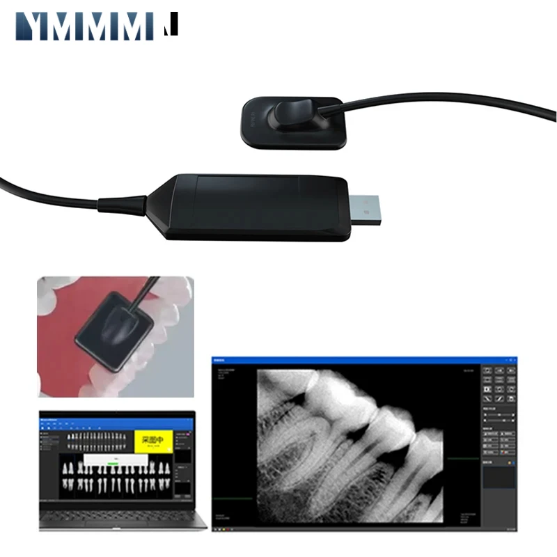 Big Size Digitale Camera's Tandheelkundige Tandheelkunde Sensor Hoogfrequente Rx Digitale Intraorale Digitale Systeem H D Beeld Radiovisografo