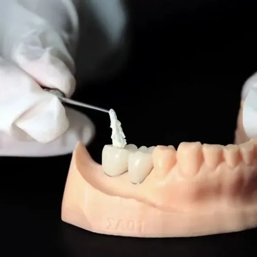 Imagen 2 del producto Extractor de material de sellado dental adecuado para cualquier sistema Impant