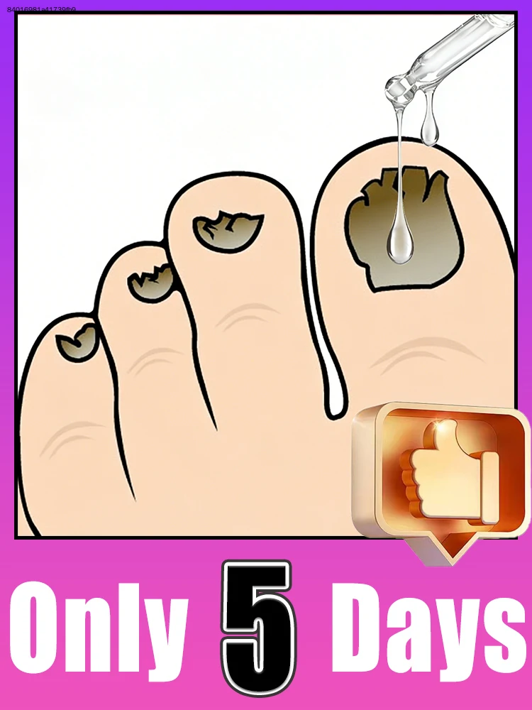 

Bɪᴅ ᴀᴅɪᴇᴜ ᴛᴏ ᴄʜᴀᴘᴘᴇᴅ ᴄᴜᴛɪᴄʟᴇs, ғɪɴɢᴇʀᴛɪᴘs ᴋᴇᴇᴘ ʟᴏɴɢ-ʟᴀsᴛɪɴɢ ᴍᴏɪsᴛᴜʀᴇ