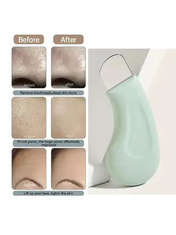 Blackhead and Whitehead Removal Tool for Nose and Face - Skin Pore Cleaner Skin Care Tools for Women
