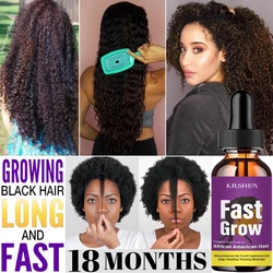 Africa Wild Ginger Hair Growth Essential Oil Crazy Thinnin Spots Loss Growth Edges Hair Traction Hair Hair Alopecia Prevent K3X4