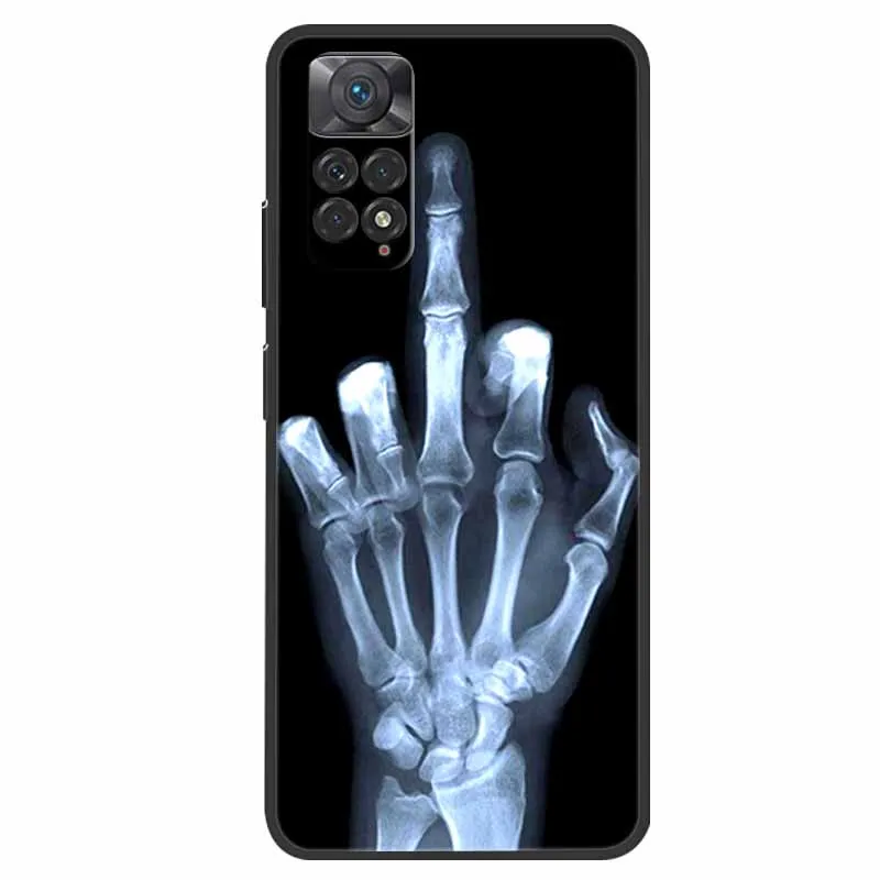 For Xiaomi Redmi Note 12 Pro 4G Case Shockproof Soft silicone TPU Back Cover For Redmi Note 12 Pro 4G Phone Cases Note12 Pro