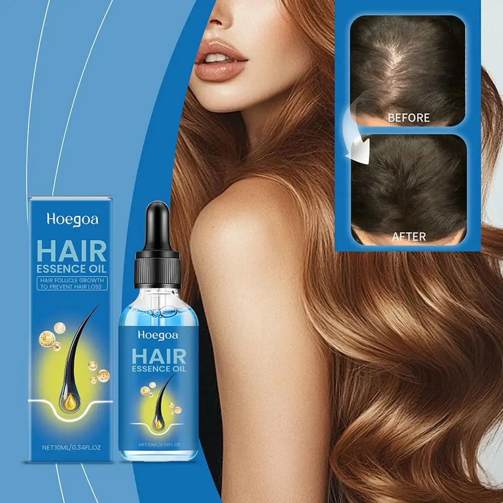 

10ml for Men Women Anti-hair loss essence Fast Grow Serum Anti Loss Regrowth Scalp Treatment Hair Care G0X4