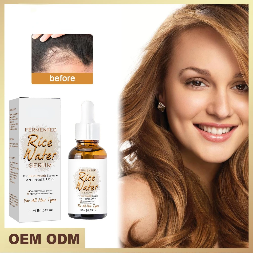 

2022 New Fermented Rice Essence Conditioner Water Hair Follicle Rice Essence Nutrition Hair Growth Care Hair Growth Oil