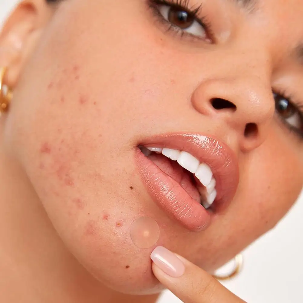 Cerotti idrocolloidi invisibili per coprire le zette e le imperfezioni, cerotti per brufoli dell'acne per adesivi per macchie del viso per tutti i tipi di pelle